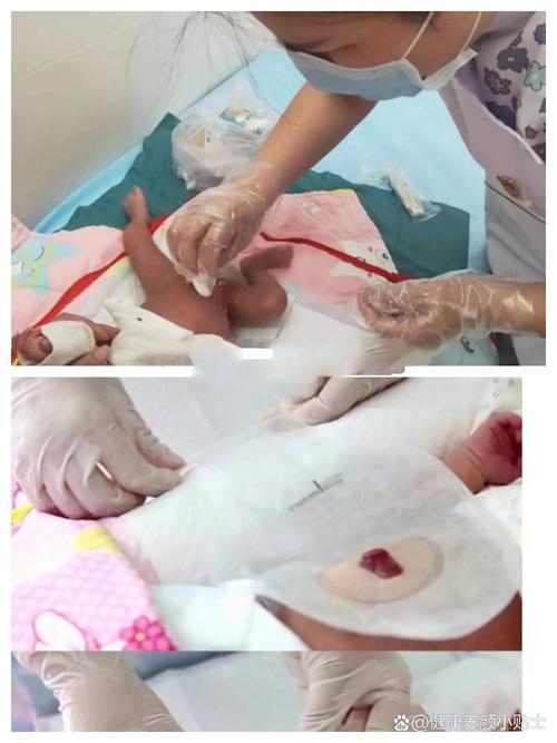 （早产儿手术后度过危险期）