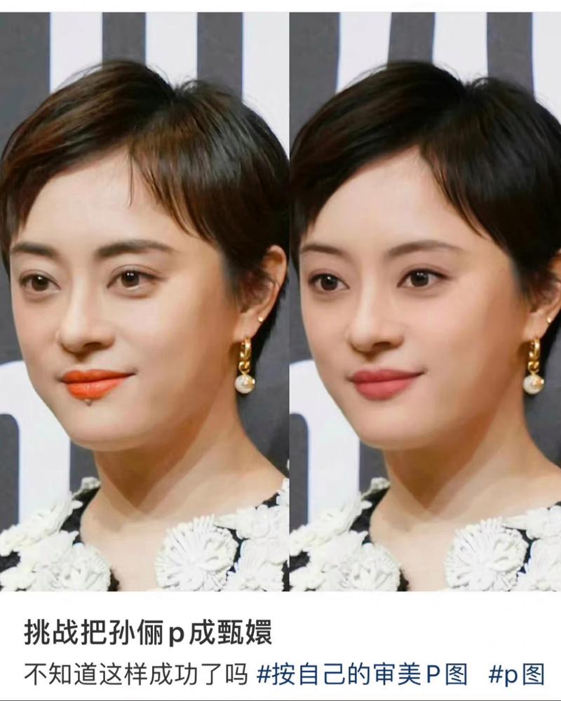 2025澳门特马开奖结果和孙俪唇下痣没了与孙俪嘴唇的痣